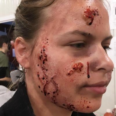 20191102 mb re aliste bellewaerde blessure et pustule de co te