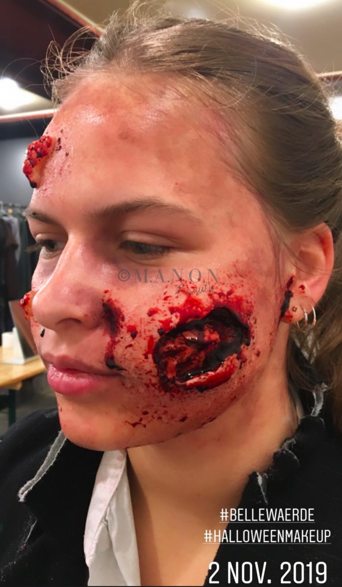 Site 20191102 mb realiste bellewaerde blessure et morsure de cote credit