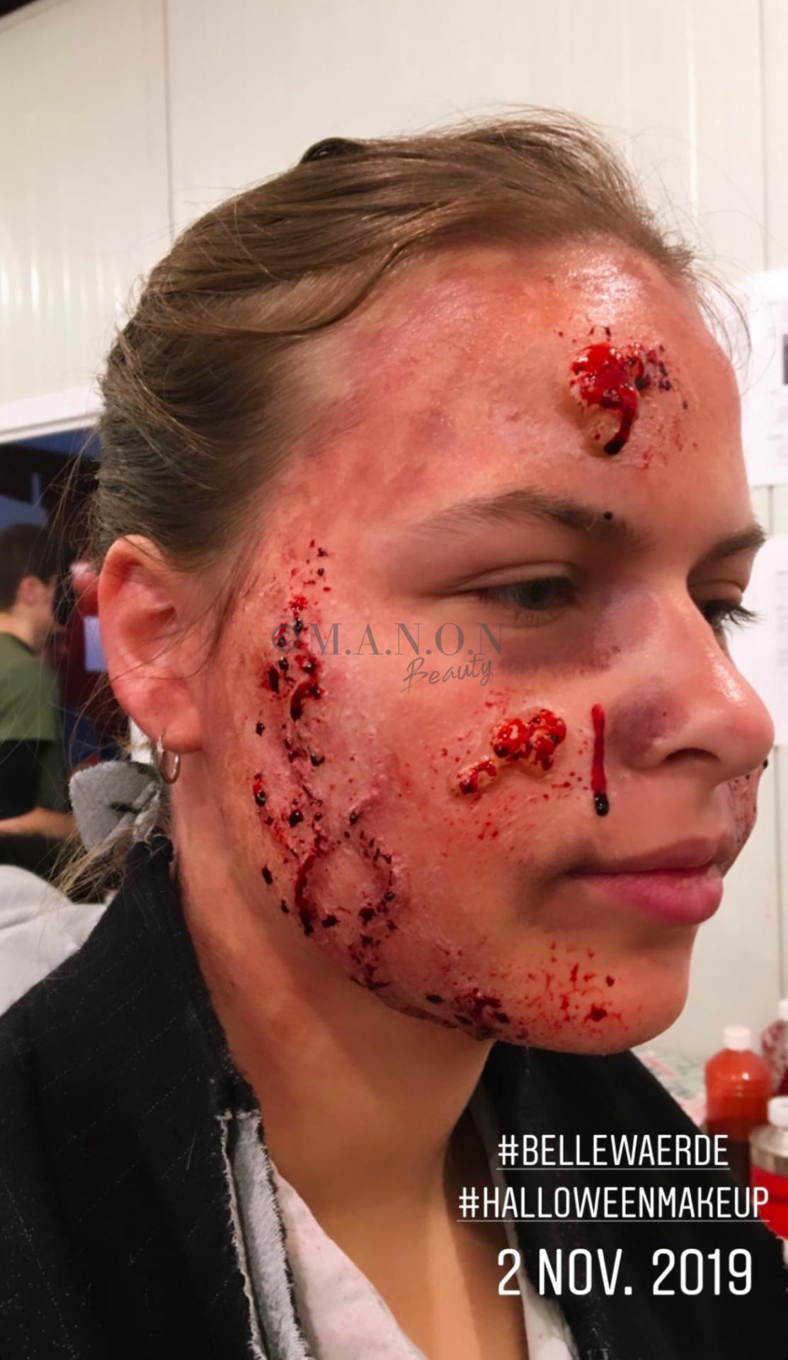 Site 20191102 mb realiste bellewaerde blessure et pustule de cote credit