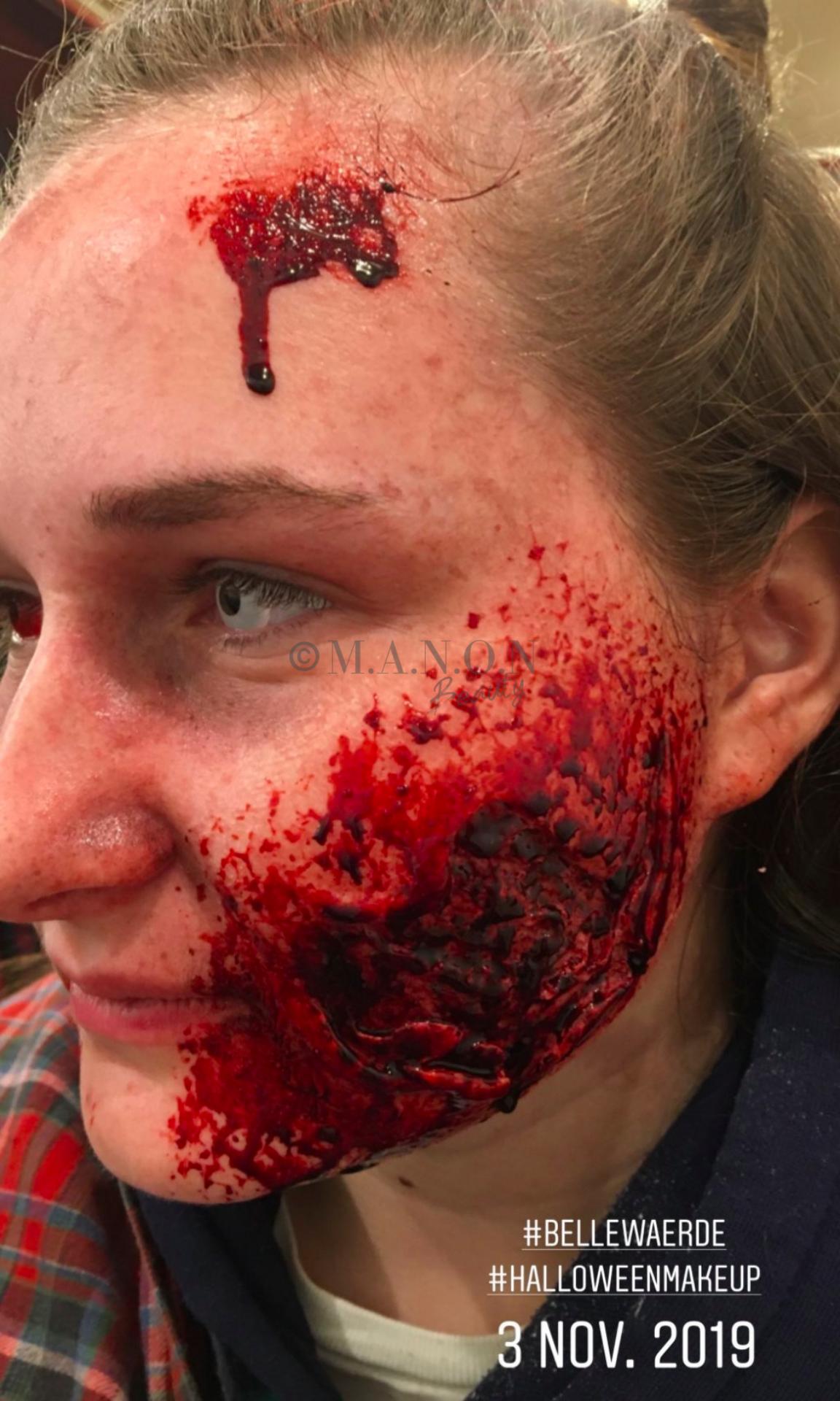 Site 20191103 mb realiste bellewaerde blessure et attaque de cote credit
