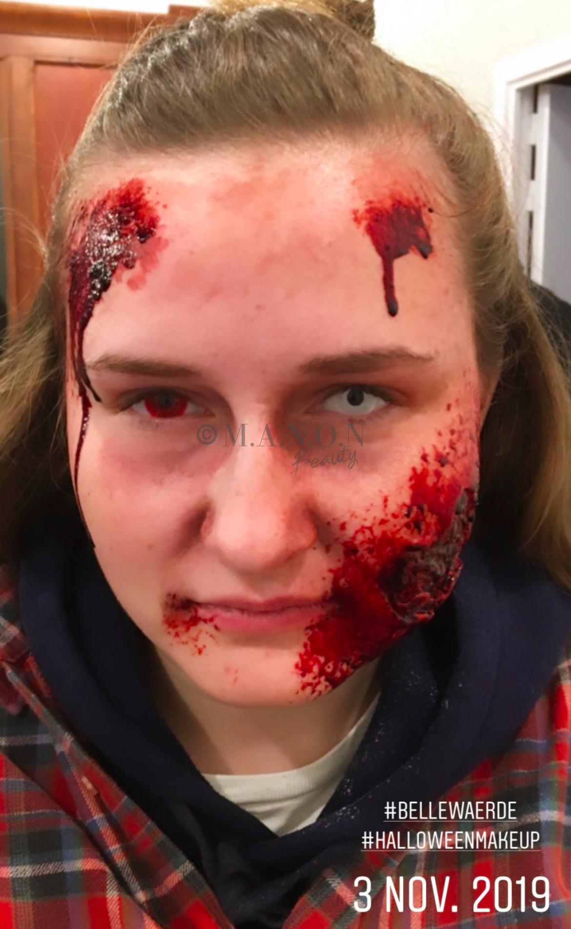 Site 20191103 mb realiste bellewaerde blessure et attaque de face credit