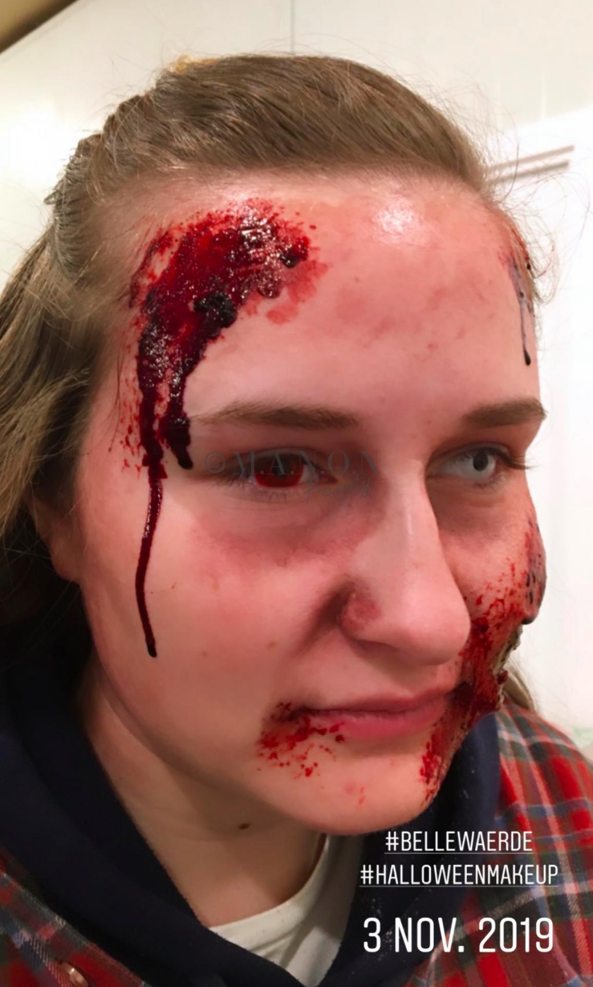 Site 20191103 mb realiste bellewaerde blessure et sang de face credit